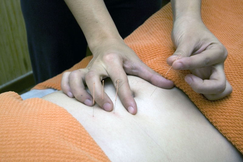 osteopathe-ENTRAUNES-min_acupuncture-4175625